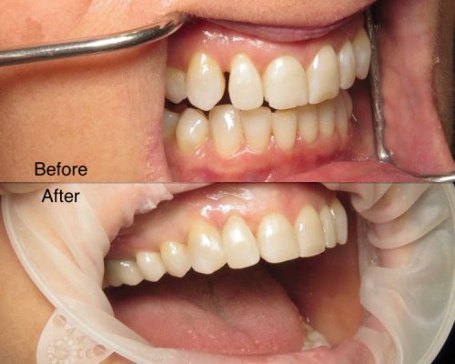 Dental before and after